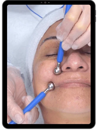 Eletrodo alta Frequência Forquilha Utilizado na Estética facial e corporal