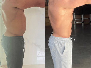 Image (Atleta fisiculturista — antes e depois)