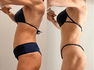 Image (Atleta/mãe idade +45 — antes e depois)