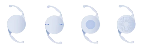 Tipos de lentes intraoculares para melhor visão, monofocal asférica, tórica, foco estendido e trifocal/multifocal