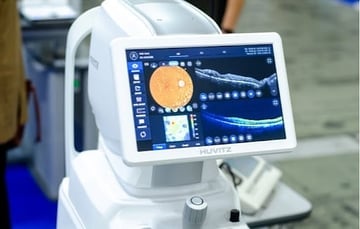 Exame de Tomografia de coerência óptica em belo horizonte mostrando alterações da mácula e da retina