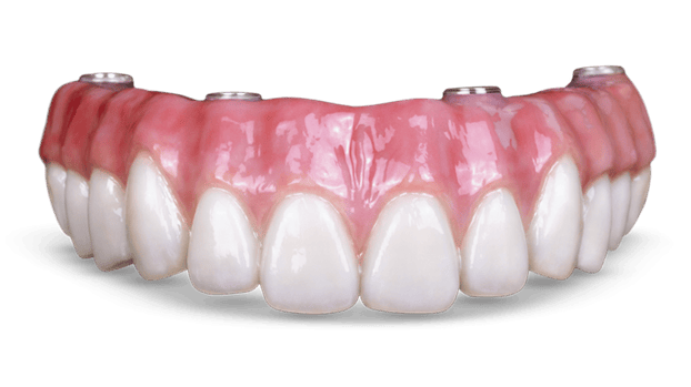 Implante dentário protocolo
