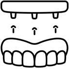 Prótese Protocolo